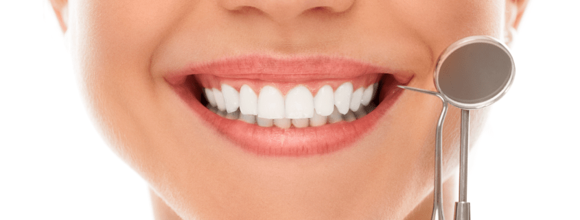 sonria tratamiento ortodoncia brackets sonria tratamiento ortodoncia brackets