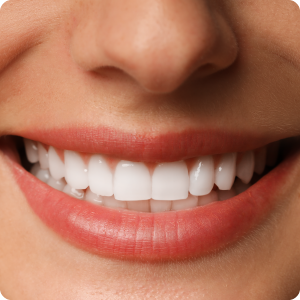Diseño de sonrisa Light
