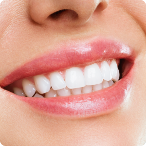 Diseño de sonrisa Medium