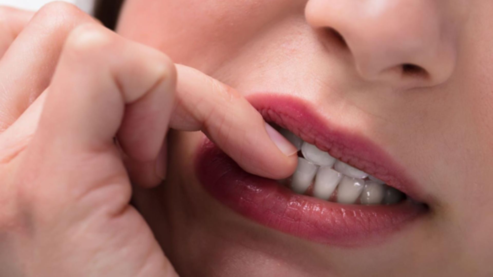 Morderse las uñas: el hábito que está afectando tu sonrisa sin que lo notes