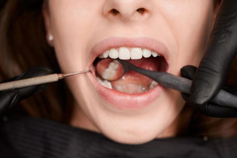¿Sabías que las caries se pueden contagiar?