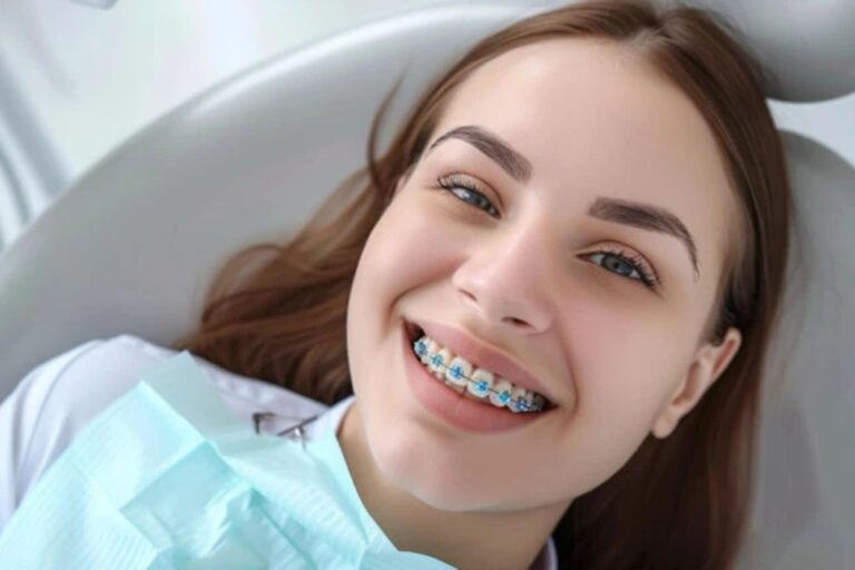 Conoce los diferentes tipos de ortodoncia en Sonría