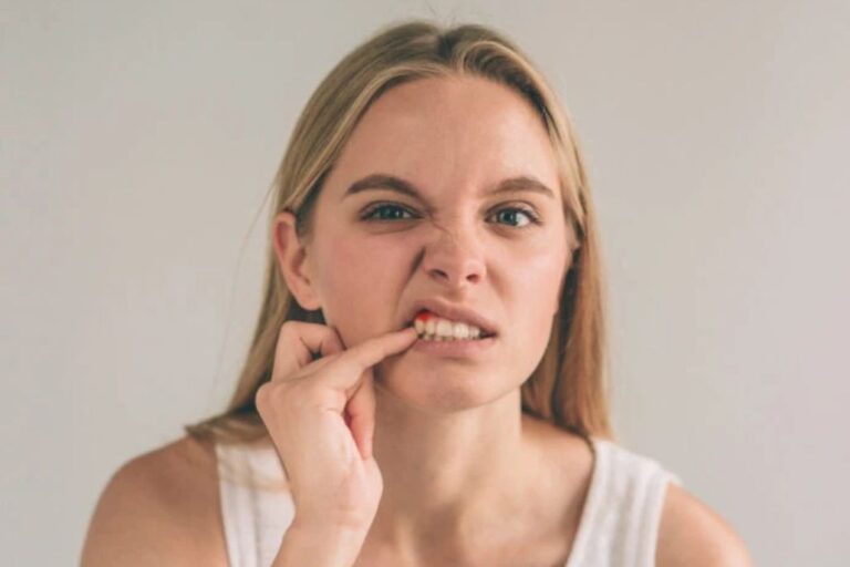 Gingivitis ¿qué es y por qué debería preocuparme?