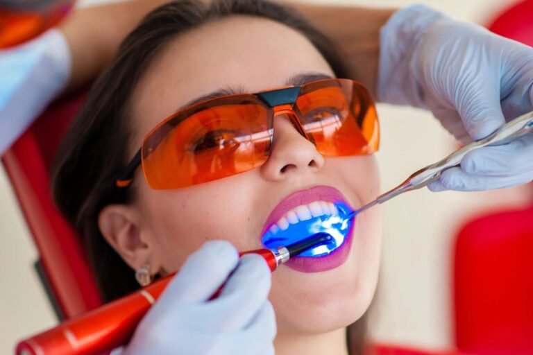 Blanqueamiento dental: la clave para una sonrisa perfecta en San Valentín