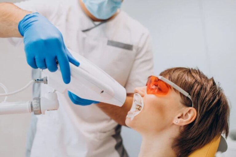Blanqueamiento dental: todo lo que debes saber